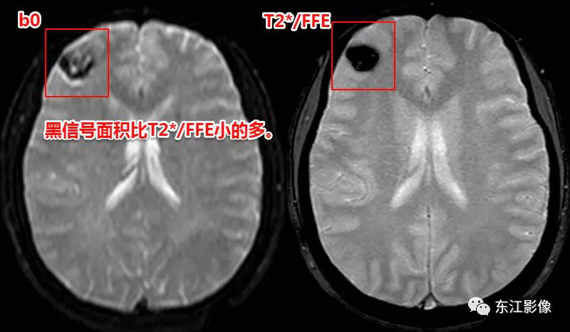 头颅mri平扫是检查什么的_头颅mri_头颅mri检查多少钱