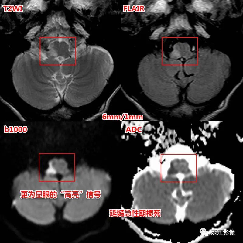 头颅mri平扫是检查什么的_头颅mri_头颅mri检查多少钱