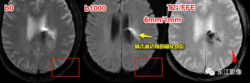 头颅mri平扫是检查什么的_头颅mri检查多少钱_头颅mri