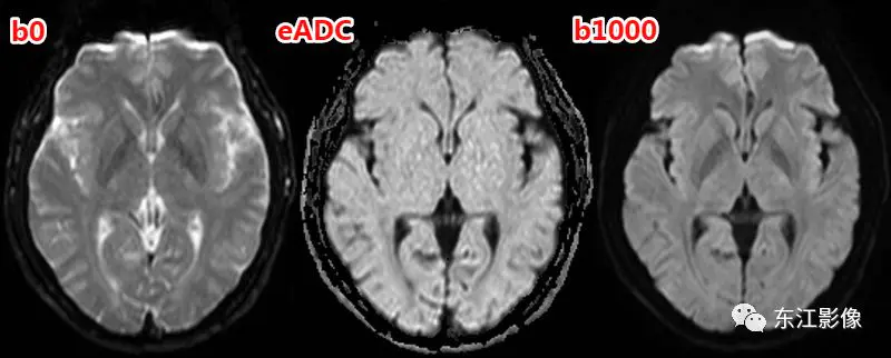 头颅mri_头颅mri平扫是检查什么的_头颅mri检查多少钱