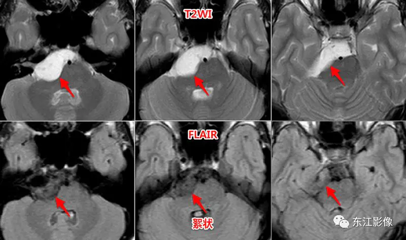 头颅mri_头颅mri平扫是检查什么的_头颅mri检查多少钱