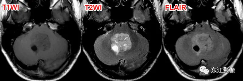 头颅mri平扫是检查什么的_头颅mri检查多少钱_头颅mri