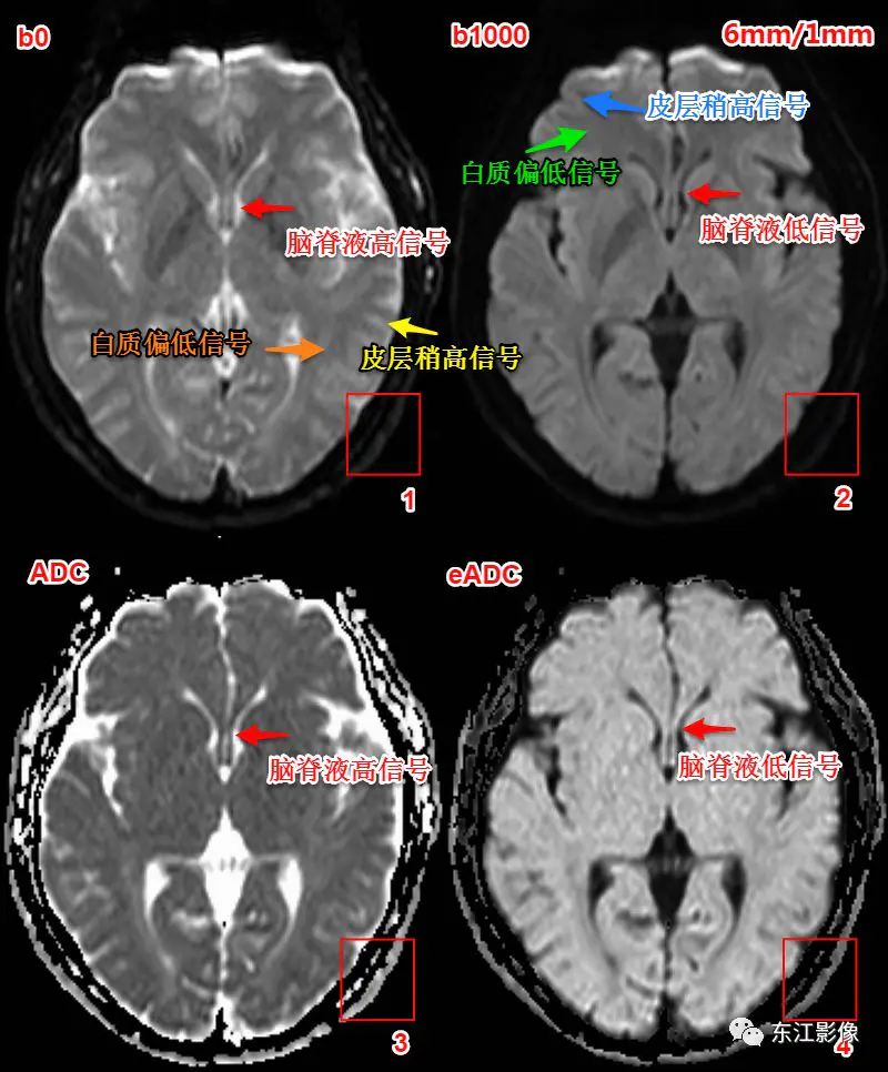 头颅mri检查多少钱_头颅mri平扫是检查什么的_头颅mri