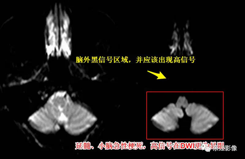 头颅mri检查多少钱_头颅mri_头颅mri平扫是检查什么的