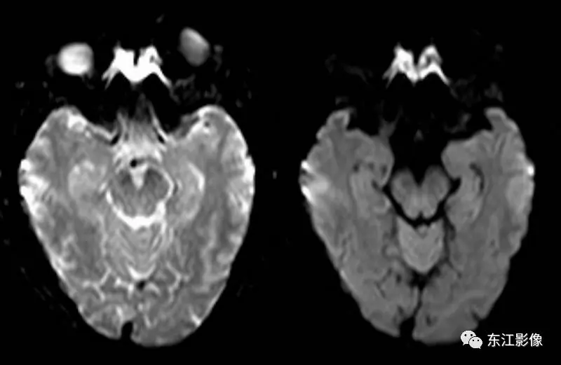 头颅mri检查多少钱_头颅mri平扫是检查什么的_头颅mri