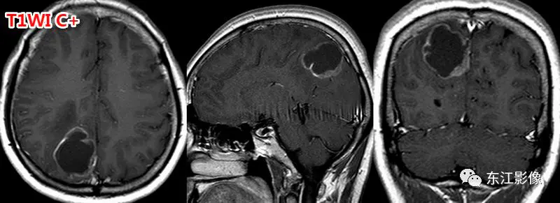 头颅mri_头颅mri平扫是检查什么的_头颅mri检查多少钱