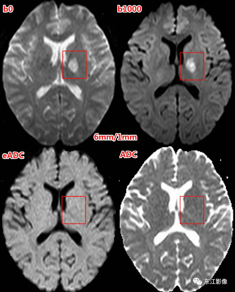 头颅mri_头颅mri检查多少钱_头颅mri平扫是检查什么的