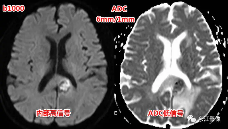 头颅mri检查多少钱_头颅mri_头颅mri平扫是检查什么的