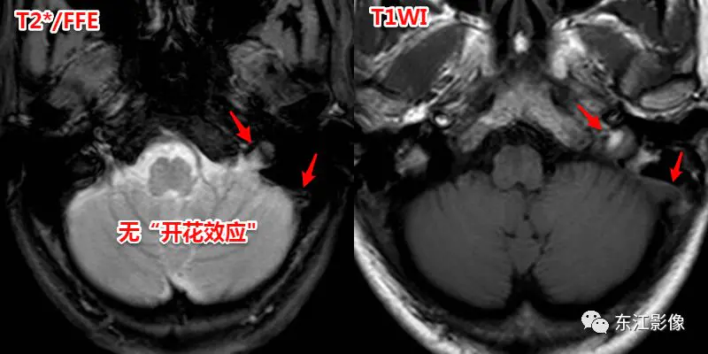 头颅mri检查多少钱_头颅mri_头颅mri平扫是检查什么的