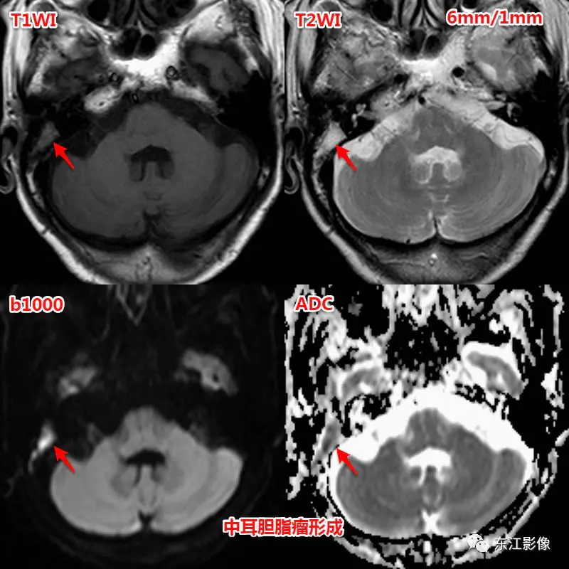 头颅mri_头颅mri检查多少钱_头颅mri平扫是检查什么的