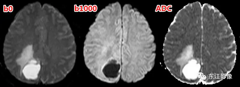 头颅mri平扫是检查什么的_头颅mri检查多少钱_头颅mri