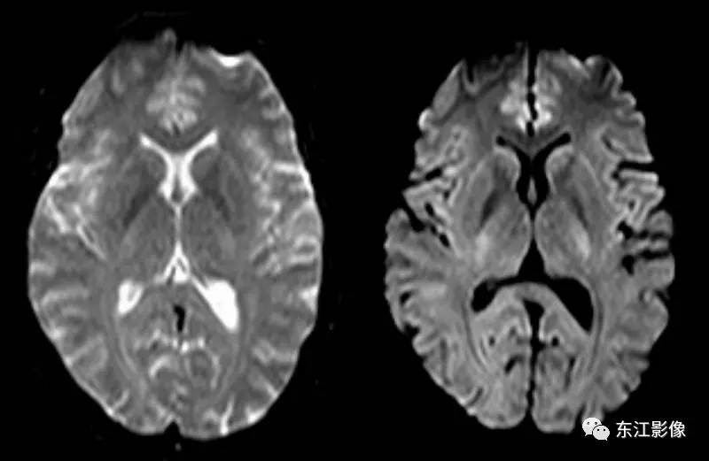 头颅mri检查多少钱_头颅mri平扫是检查什么的_头颅mri