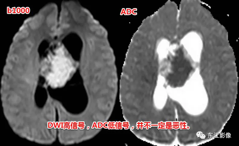 头颅mri_头颅mri平扫是检查什么的_头颅mri检查多少钱