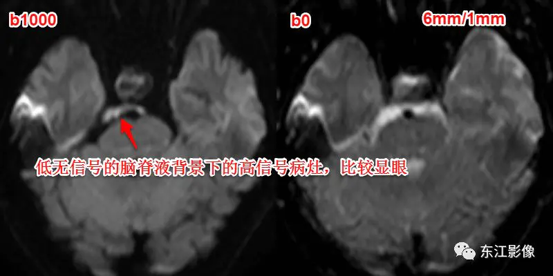 头颅mri检查多少钱_头颅mri_头颅mri平扫是检查什么的