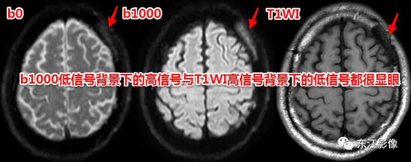 头颅mri平扫是检查什么的_头颅mri_头颅mri检查多少钱