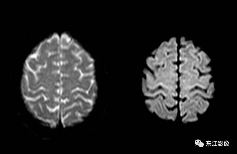 头颅mri检查多少钱_头颅mri_头颅mri平扫是检查什么的