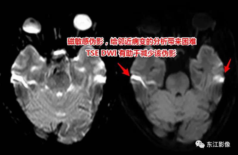 头颅mri平扫是检查什么的_头颅mri检查多少钱_头颅mri