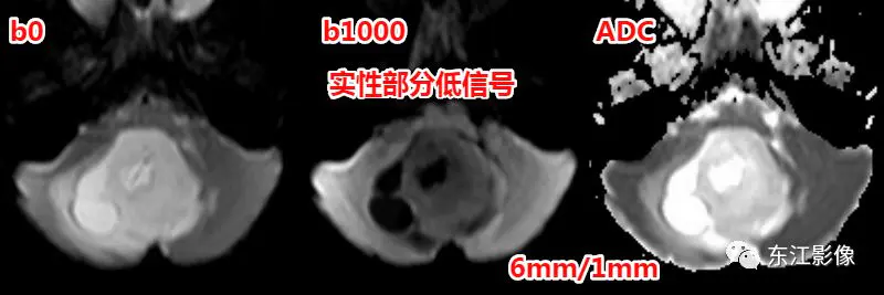 头颅mri平扫是检查什么的_头颅mri_头颅mri检查多少钱