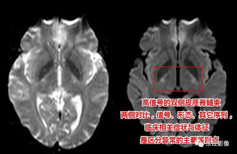 头颅mri检查多少钱_头颅mri平扫是检查什么的_头颅mri