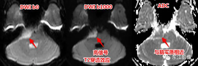 头颅mri_头颅mri平扫是检查什么的_头颅mri检查多少钱