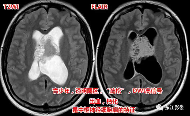 头颅mri_头颅mri检查多少钱_头颅mri平扫是检查什么的