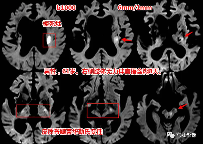 头颅mri检查多少钱_头颅mri_头颅mri平扫是检查什么的