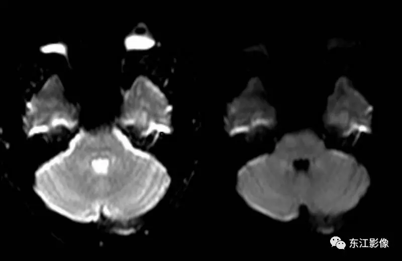 头颅mri检查多少钱_头颅mri平扫是检查什么的_头颅mri