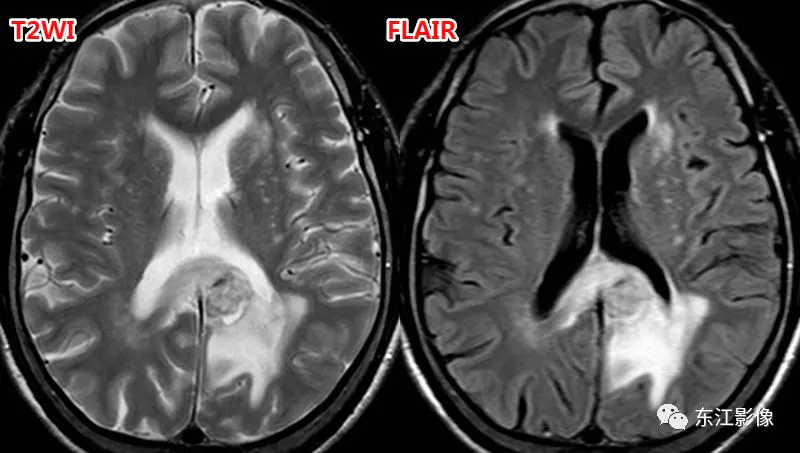 头颅mri_头颅mri平扫是检查什么的_头颅mri检查多少钱