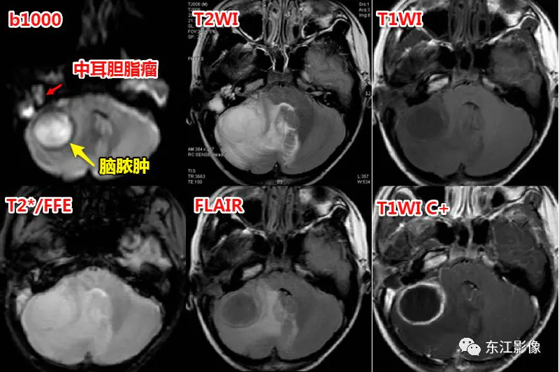 头颅mri_头颅mri平扫是检查什么的_头颅mri检查多少钱