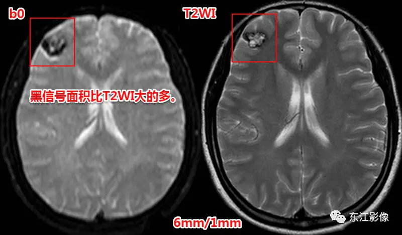 头颅mri_头颅mri平扫是检查什么的_头颅mri检查多少钱