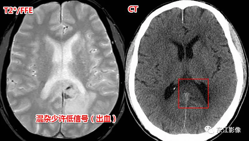 头颅mri检查多少钱_头颅mri平扫是检查什么的_头颅mri