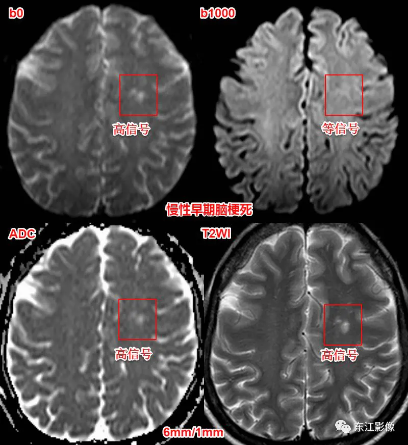 头颅mri平扫是检查什么的_头颅mri检查多少钱_头颅mri