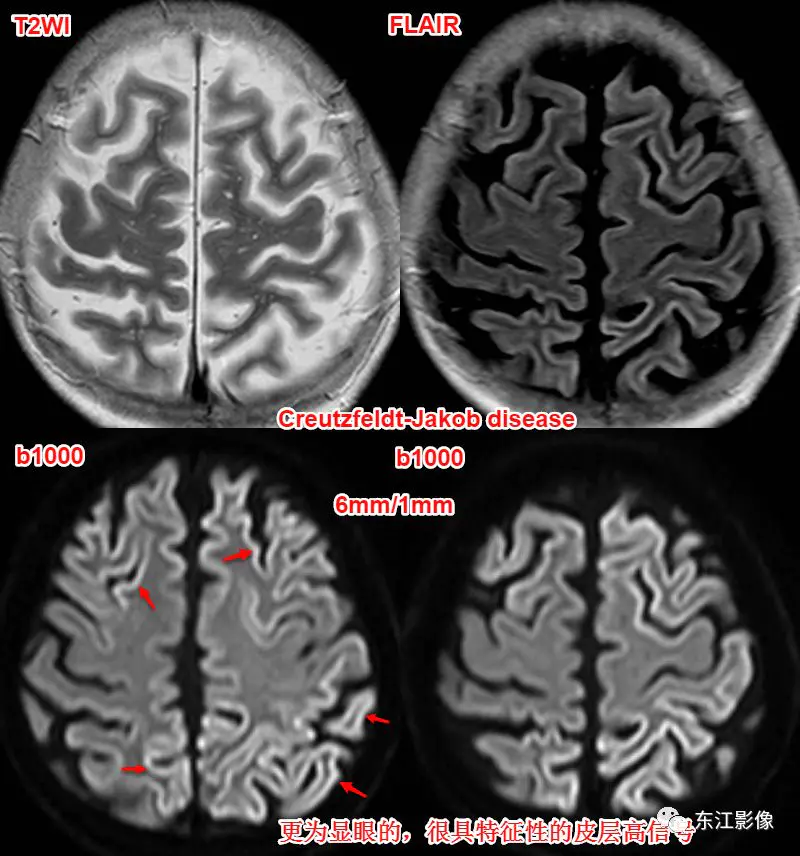 头颅mri平扫是检查什么的_头颅mri_头颅mri检查多少钱