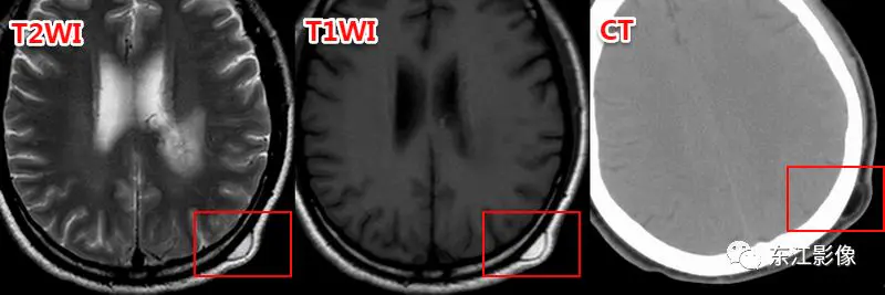 头颅mri检查多少钱_头颅mri平扫是检查什么的_头颅mri