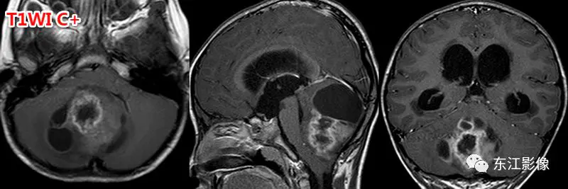 头颅mri平扫是检查什么的_头颅mri_头颅mri检查多少钱