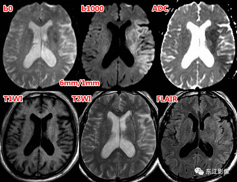 头颅mri平扫是检查什么的_头颅mri检查多少钱_头颅mri