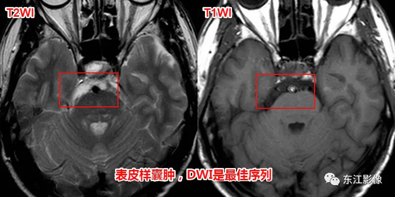 头颅mri平扫是检查什么的_头颅mri检查多少钱_头颅mri