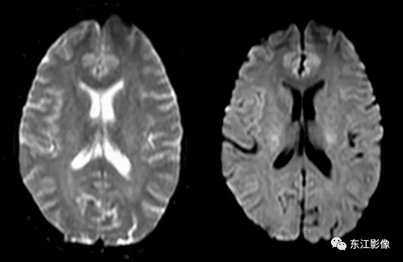 头颅mri检查多少钱_头颅mri_头颅mri平扫是检查什么的