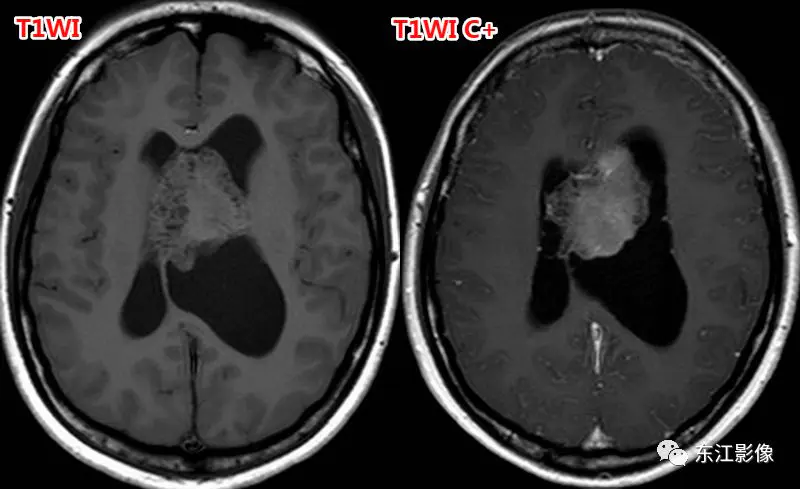 头颅mri_头颅mri平扫是检查什么的_头颅mri检查多少钱