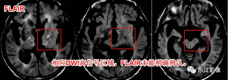 头颅mri检查多少钱_头颅mri平扫是检查什么的_头颅mri