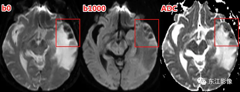 头颅mri_头颅mri检查多少钱_头颅mri平扫是检查什么的