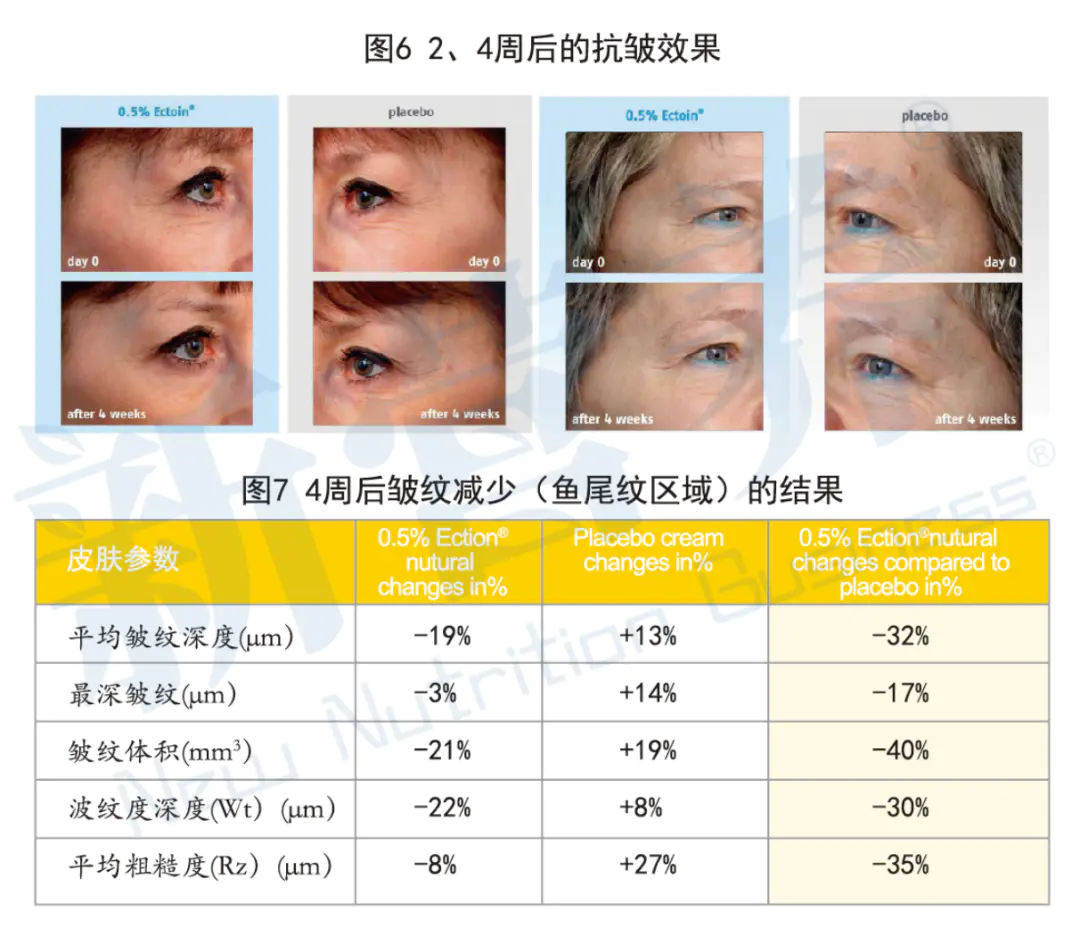 依克多因对皮肤的作用_克莫格皮肤